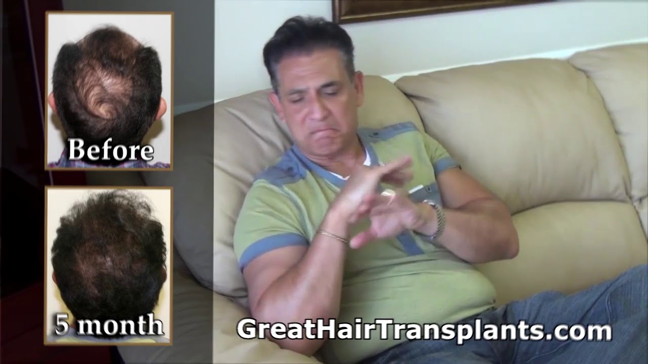 Hair Restoration Clinic For Men And Women In Plantation, Florida - Dr. Brett Bolton