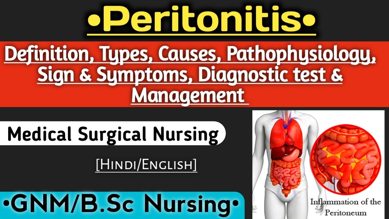 Peritonitis - Definition, causes, types, pathophysiology, s/s, diagnostic test, mgt @NursingCriteria