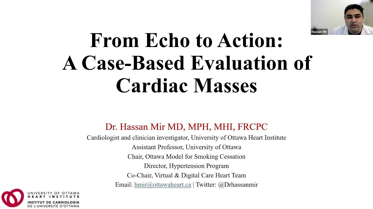 From Echo to Action: A Case-Based Evaluation of Cardiac Masses