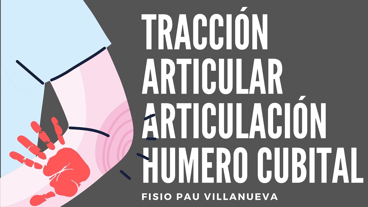 TRACCIÓN ARTICULAR DE CODO - Humero-Cubital