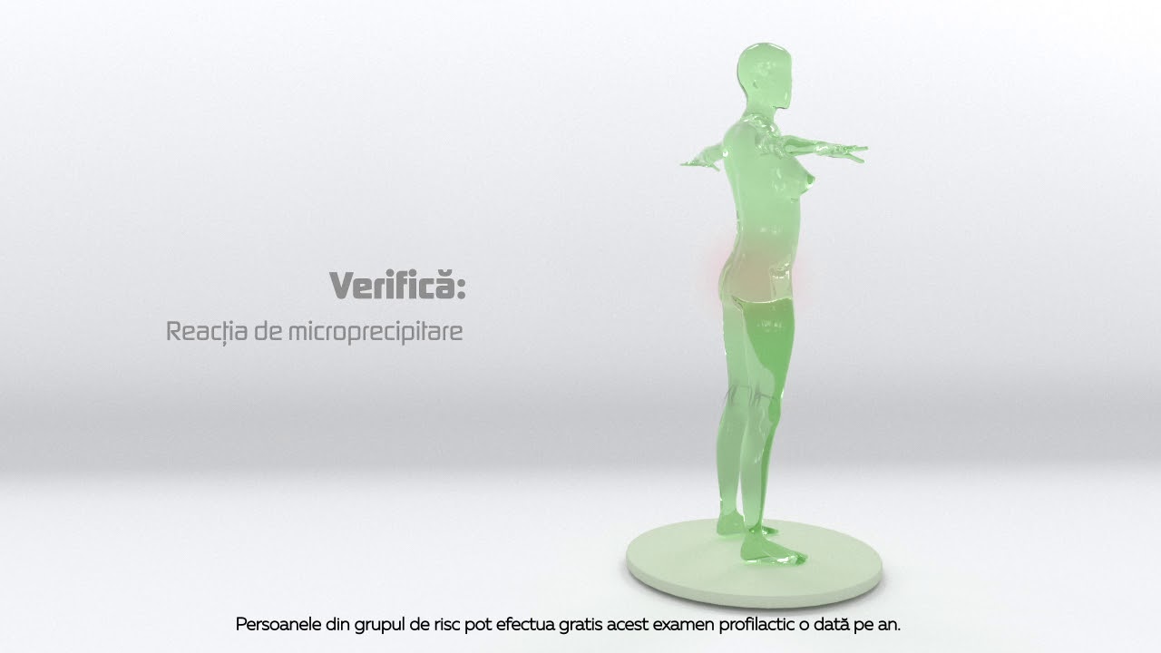 CNAM verificarea reacției de microprecipitare