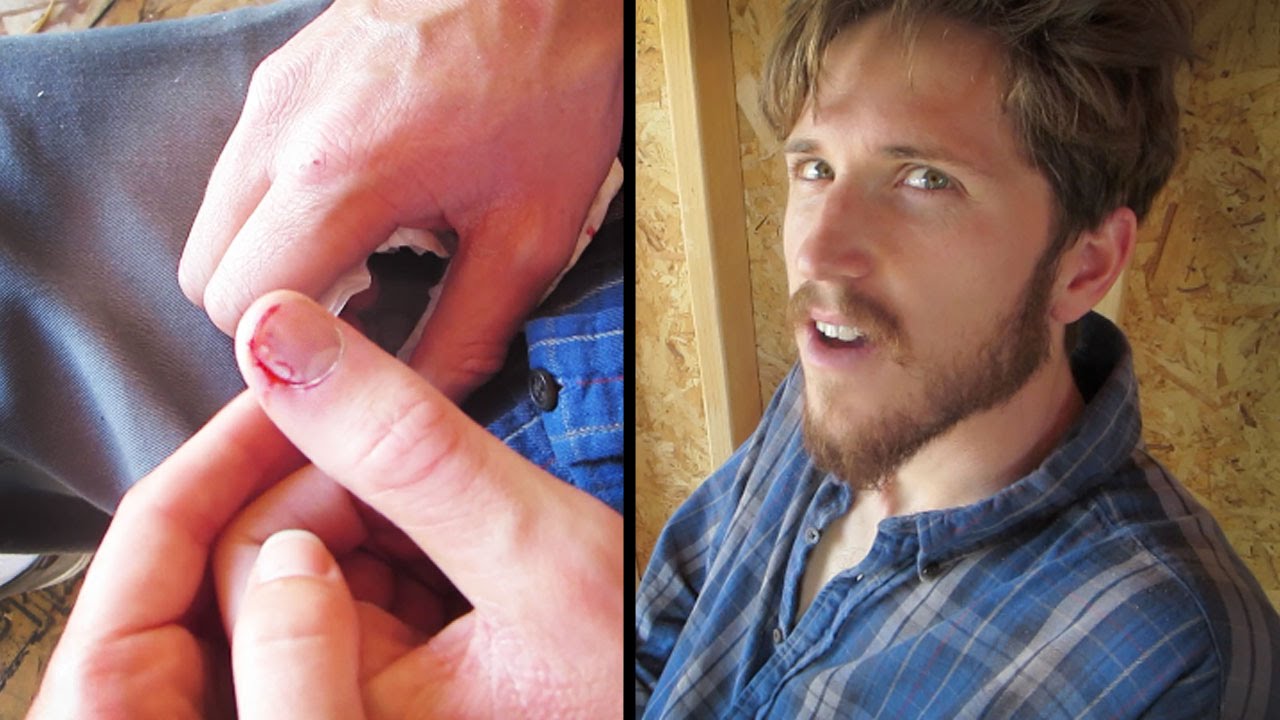 SLEDGE HAMMER ACCIDENT!