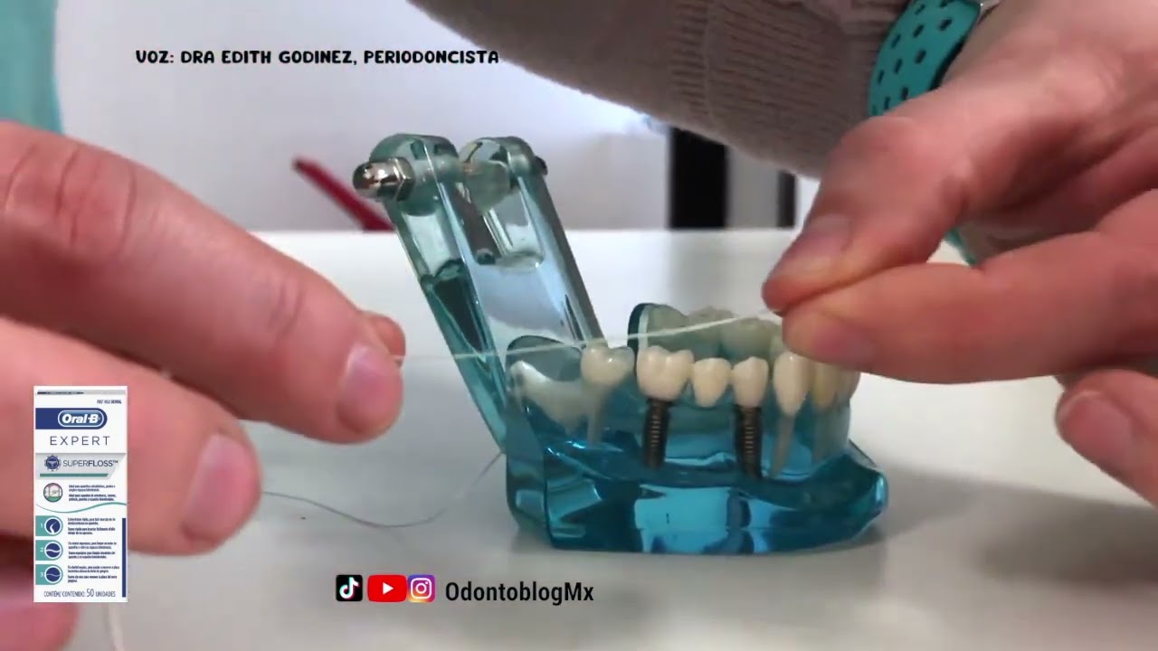 Uso de Hilo Dental Oral-B Superfloss