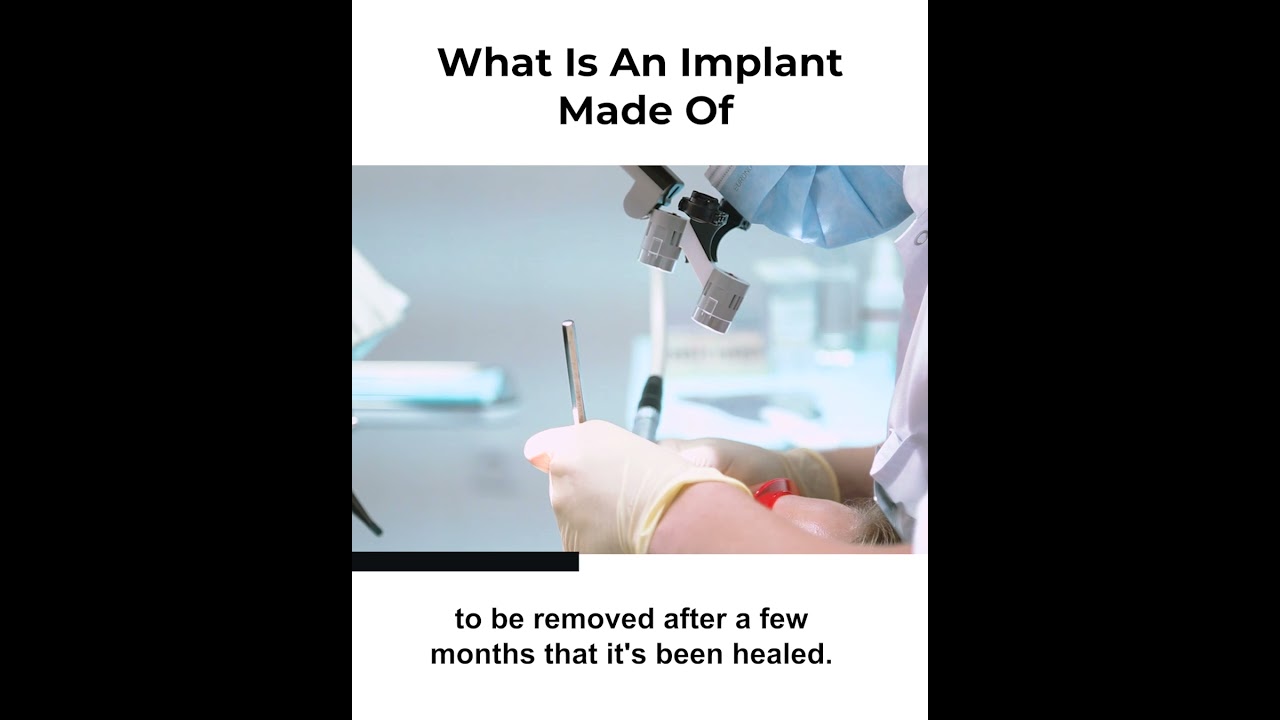 What Is An Implant Made Of?