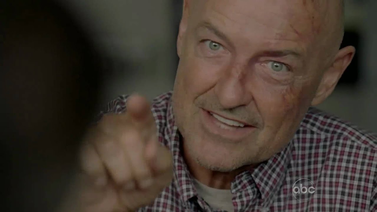 LOST: Locke is ready for the surgery