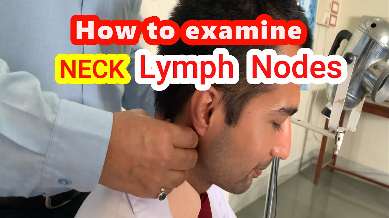 Examination of Lymph Nodes of Neck// ENT Practical // ENT viva