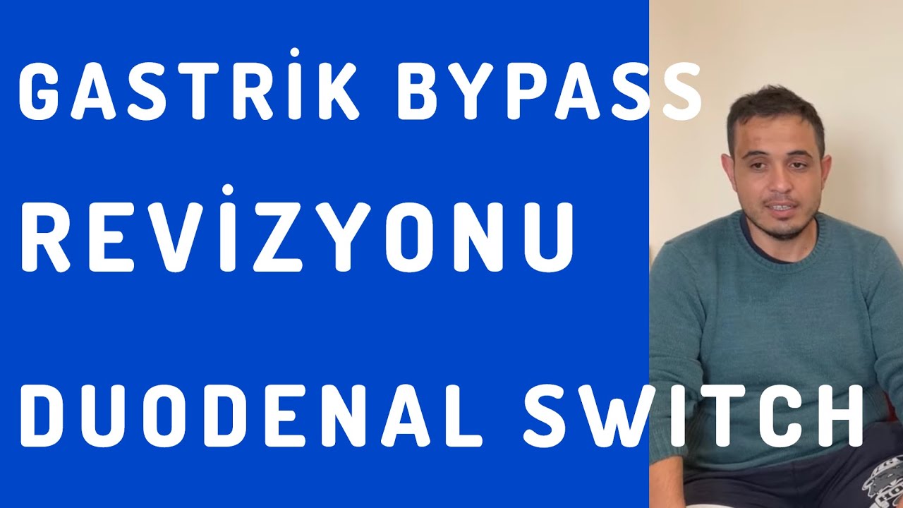 Gastrik Bypass Sonrası Dumping Sendromu  Nedeniyle Duodenal Switch’e Revizyon