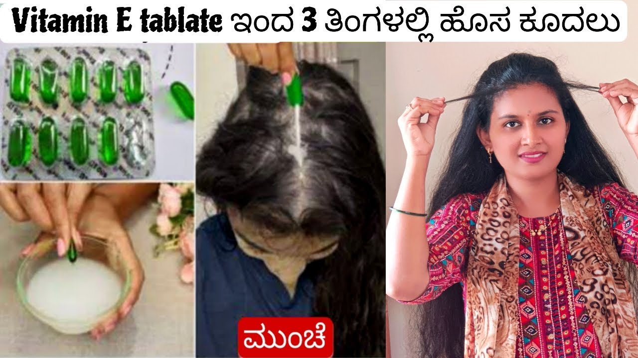 90 ದಿನದ ಚಾಲೆಂಜ್ - ಈ Vitamin-E ಸಿರಮ್ ಹಚ್ಚಿ ನನ್ಮ ಕೂದಲಲ್ಲಿ ಆದ ಬದಲಾವಣೆ ನೋಡಿ Hair Growth got double