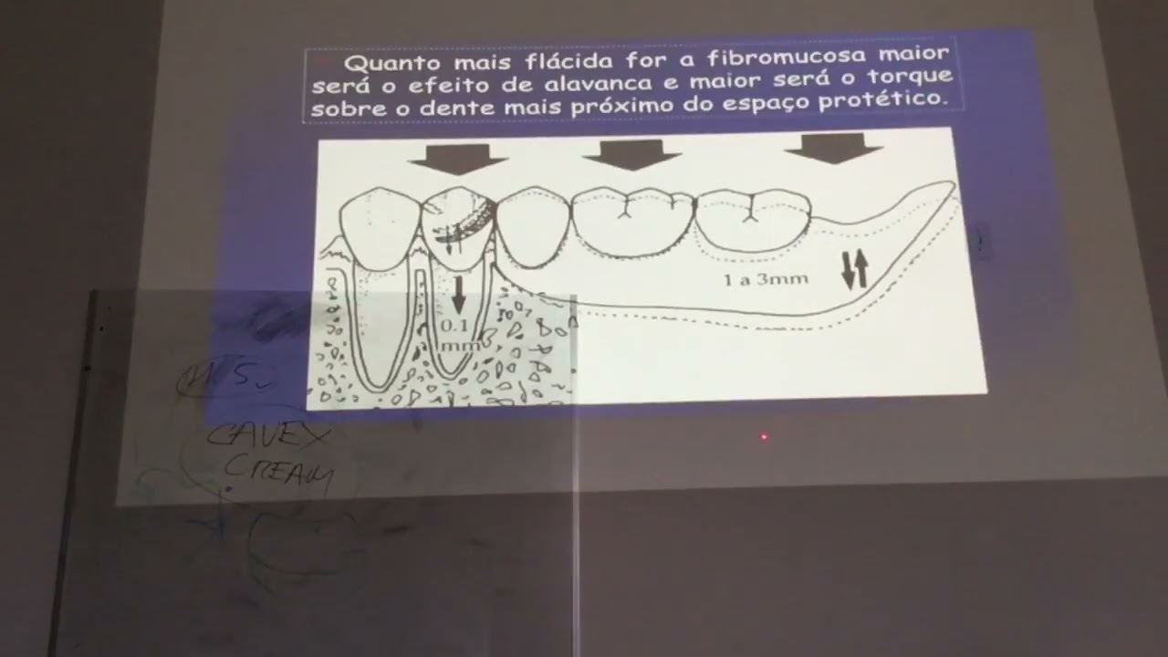 24. Moldagem funcional em PPR. Prof. Dr. Eduardo Chorres DOL UFS 13 03 2023