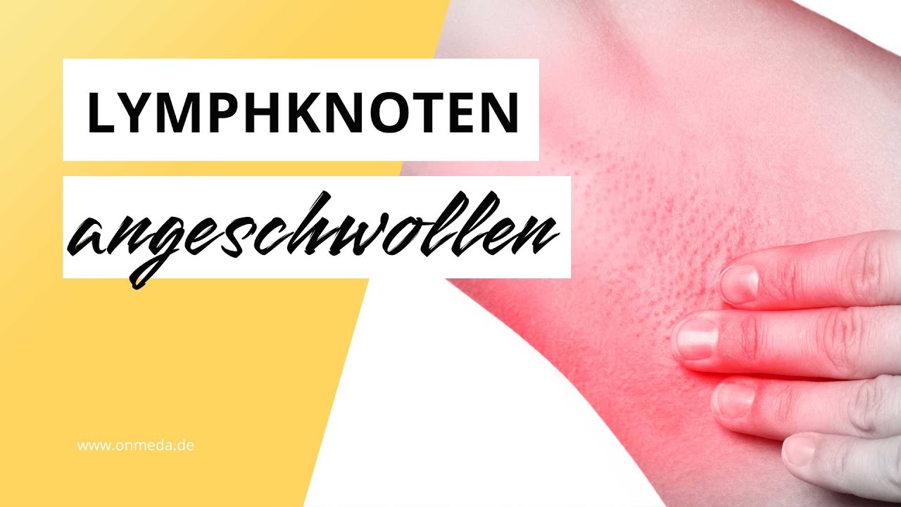 Geschwollene Lymphknoten in der Achsel: Das sind die m&ouml;glichen Ursachen