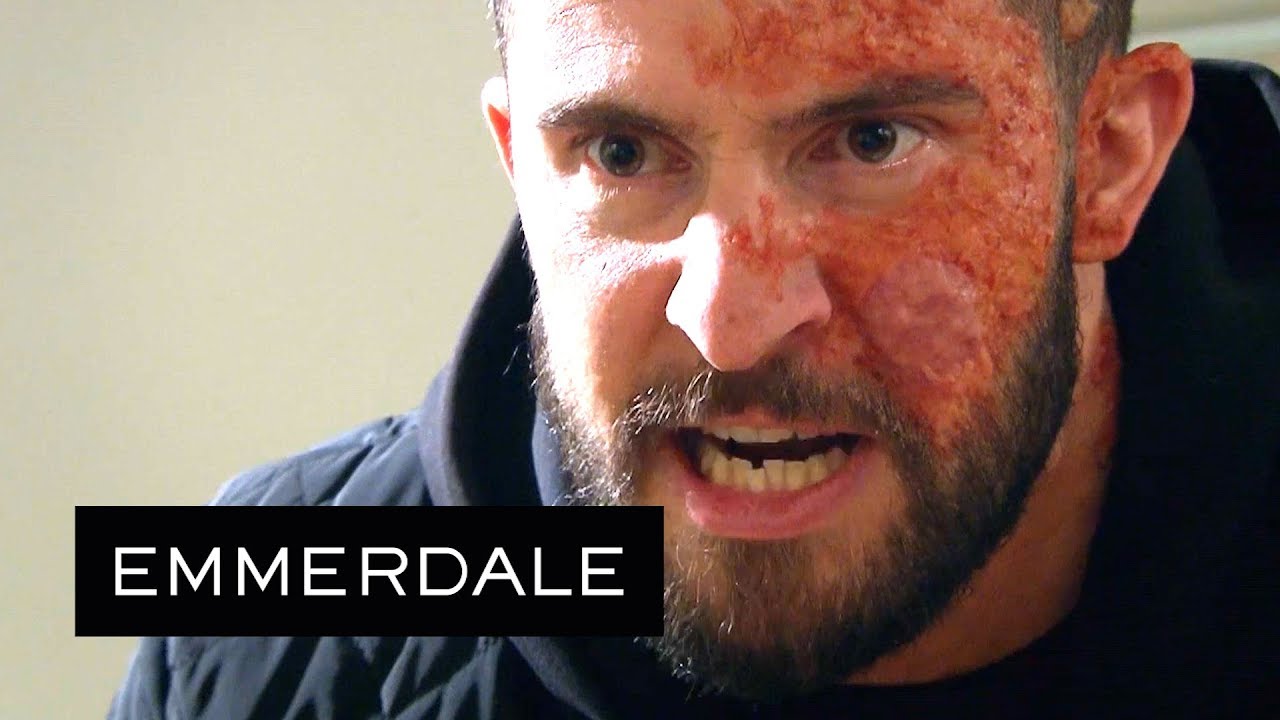 Emmerdale - Ross Will Make Sure Debbie Suffers Every Day