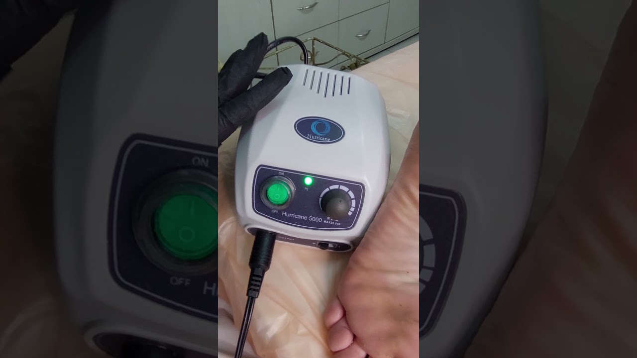 פדיקור ללא סכינים בשיטת המאסטר אורלי דואני טיפול בסדקים בשיטה משולבת ראש שיוף והמסה