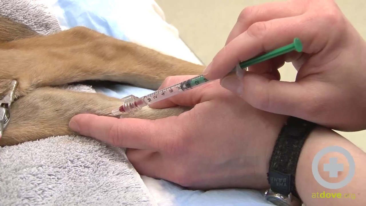 How to Perform an Arterial Blood Draw