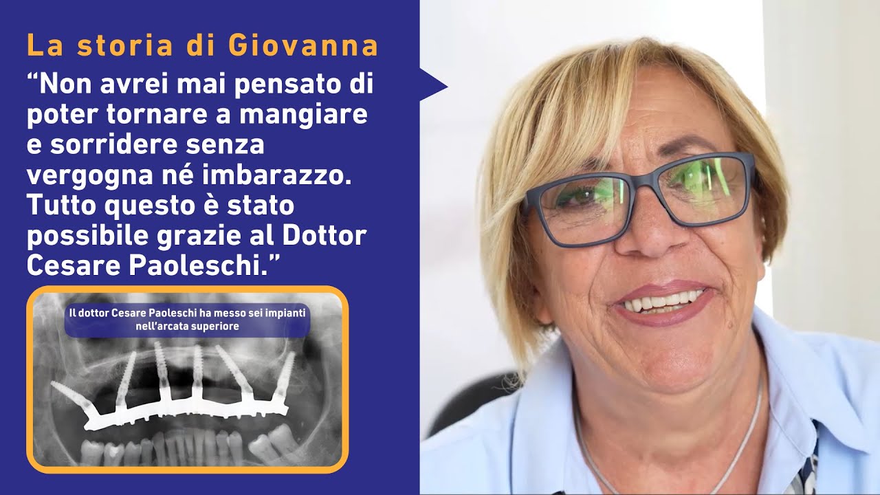 Impianti Dentali a Carico Immediato: la storia di Giovanna