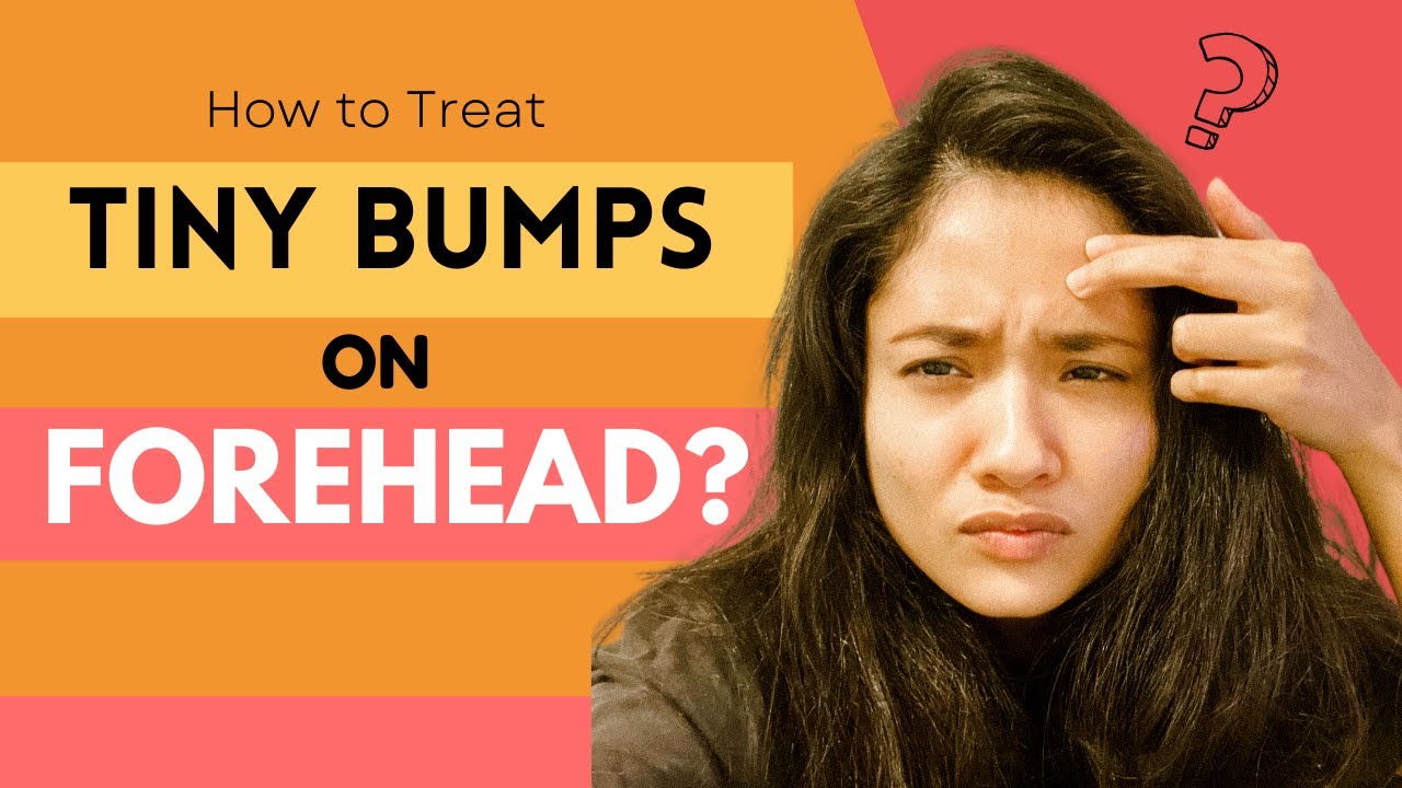 Why You Have Tiny Bumps on Forehead & How to Treat it