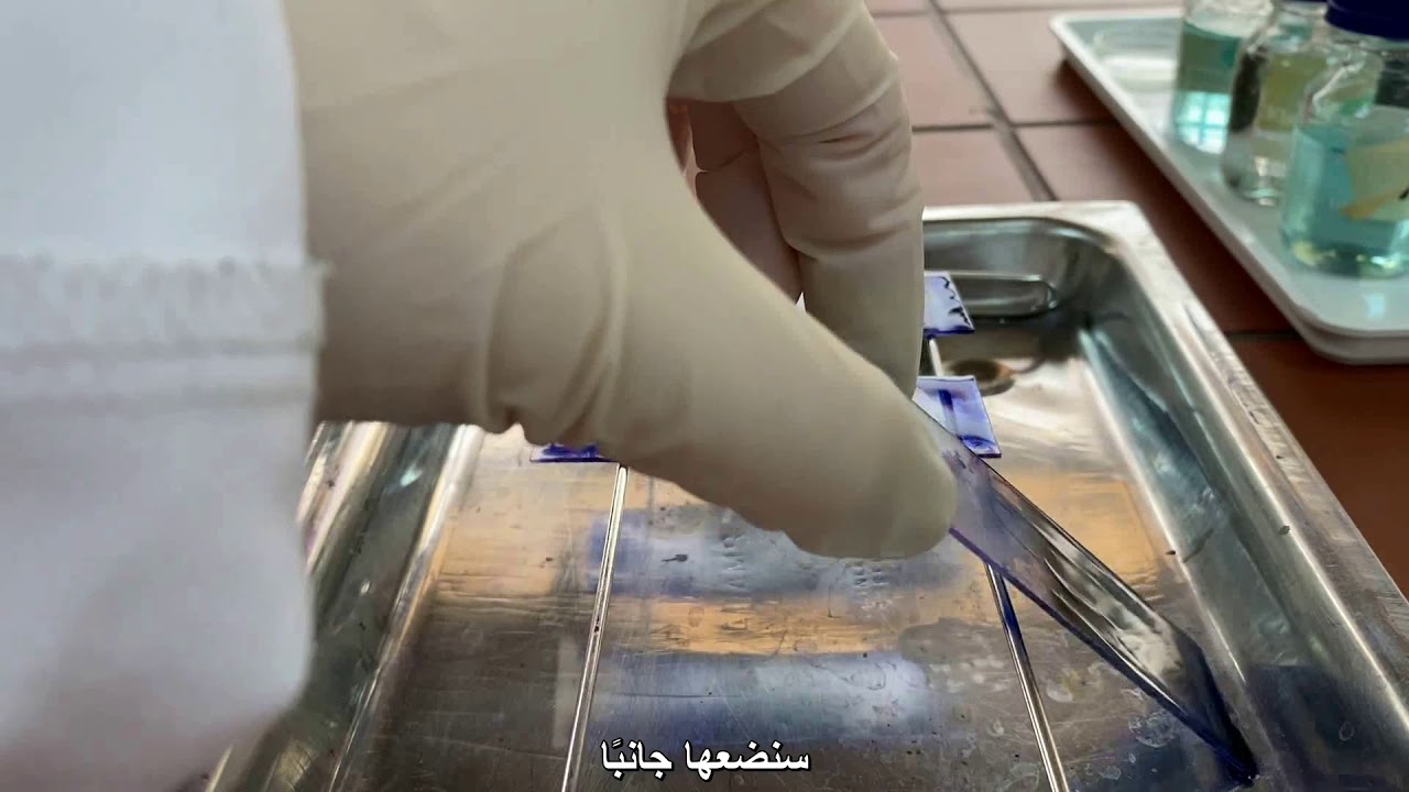 تجربة عد كريات الدم البيضاء المختلفة