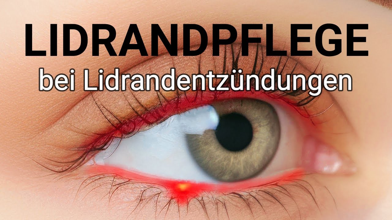 Lidrandpflege bei Lidrandentzündungen
