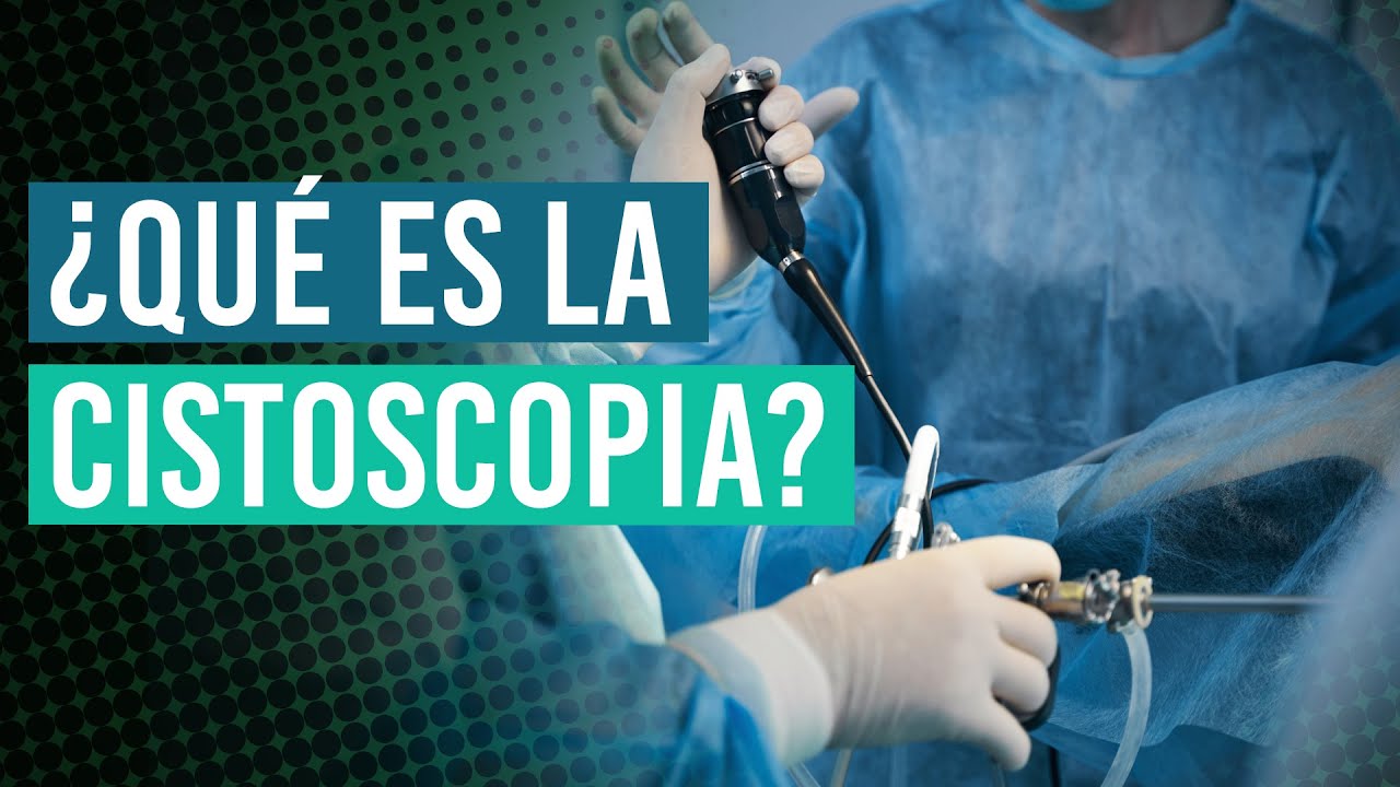 ¿Qué es la cistoscopia? ¿Cuándo se realiza? | Esto es lo que tienes que saber