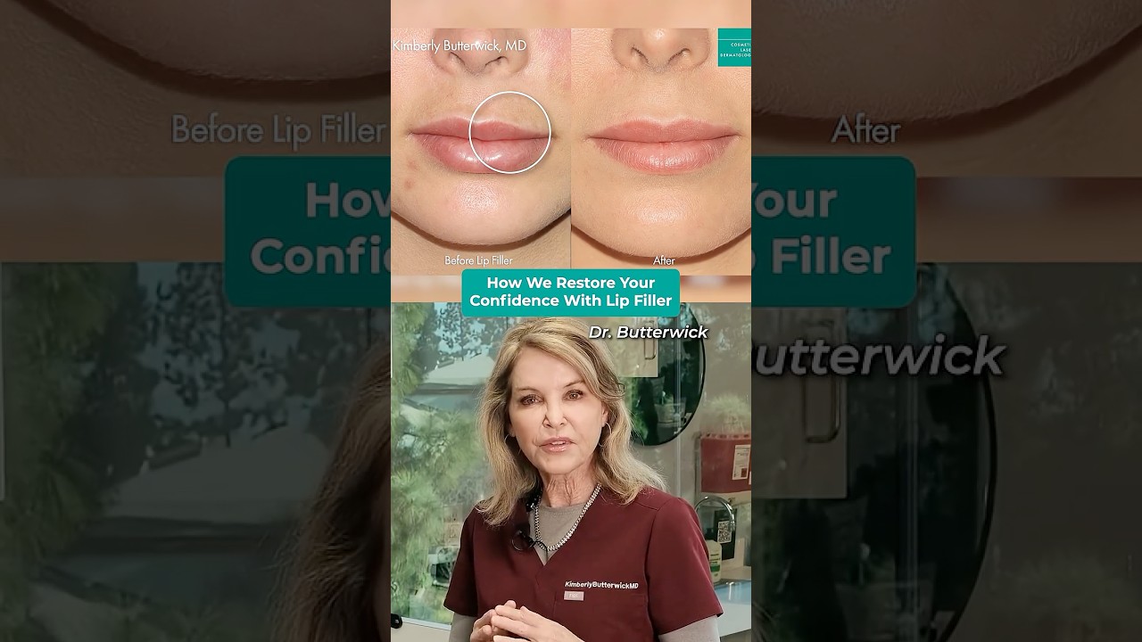 Fixing Bad Lip Filler: How We Correct Unnatural Results