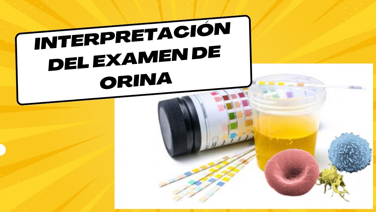 Interpretación del examen general de orina