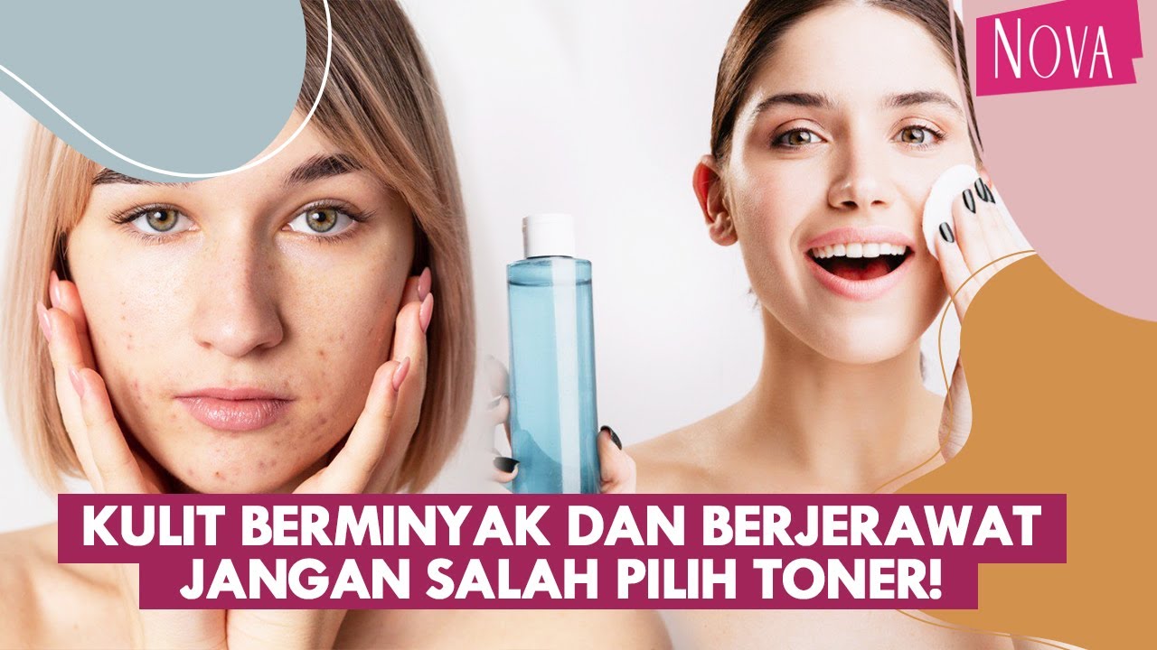 Tips Memilih Toner untuk Kulit Berminyak dan Berjerawat
