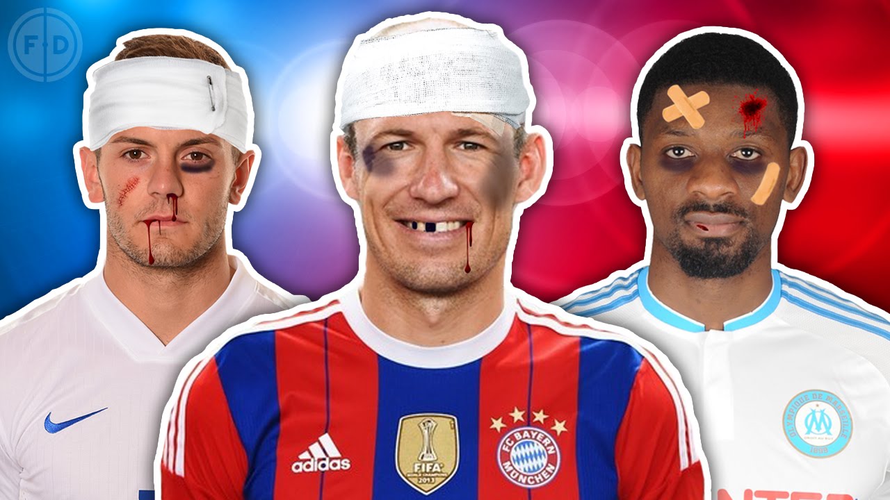Most Injury Prone XI | Sturridge, Robben, Diaby!