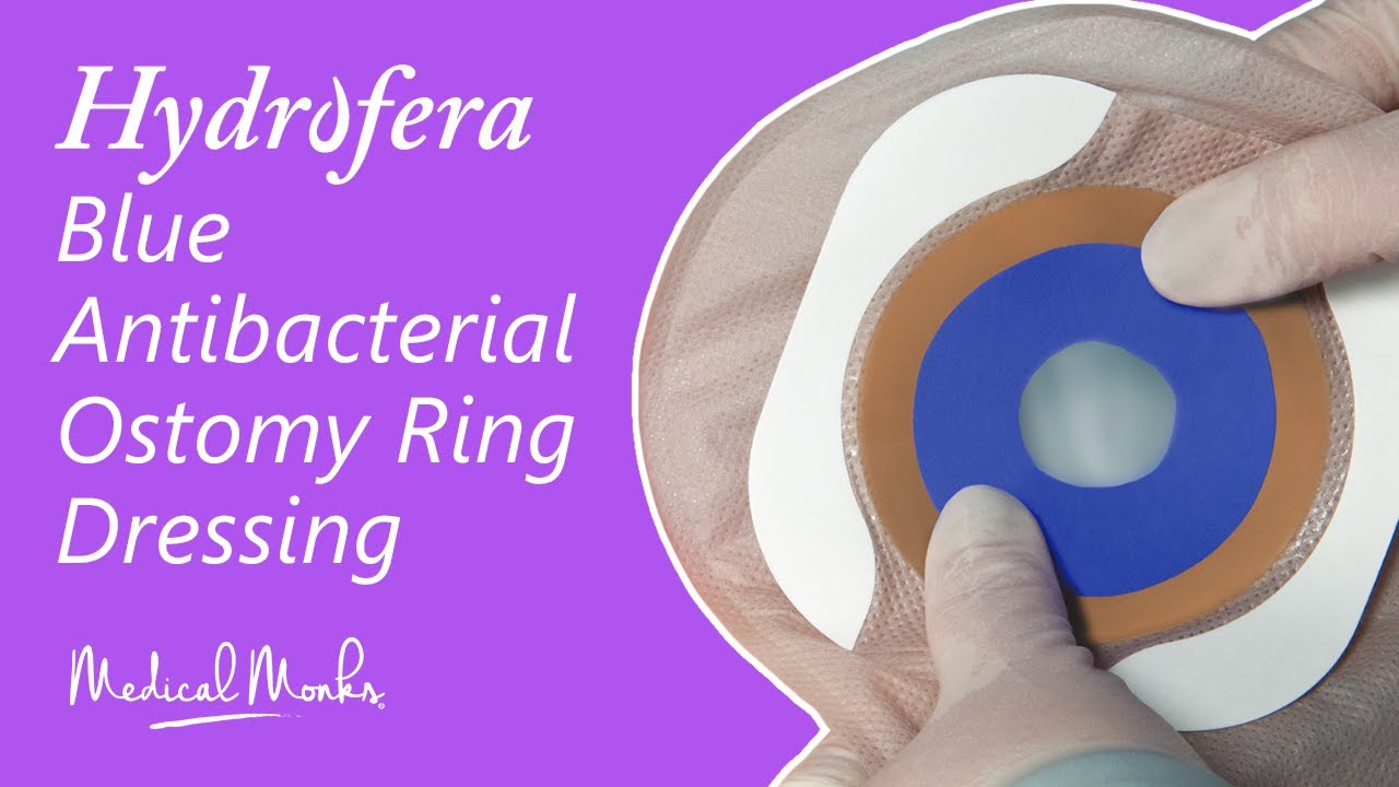 Product Demo: Hydrofera Blue Antibacterial Ostomy Ring Dressing | Medical Monks