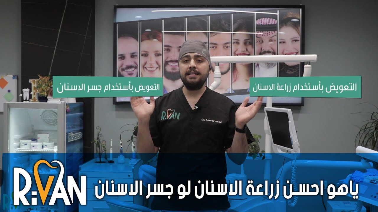 شنو الافضل جسر الاسنان لو زراعة الاسنان