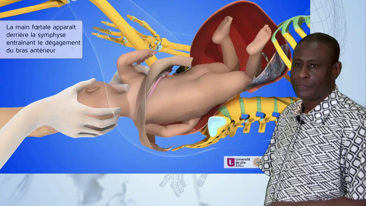 Dr BA  Accouchement La manœuvre de Couder