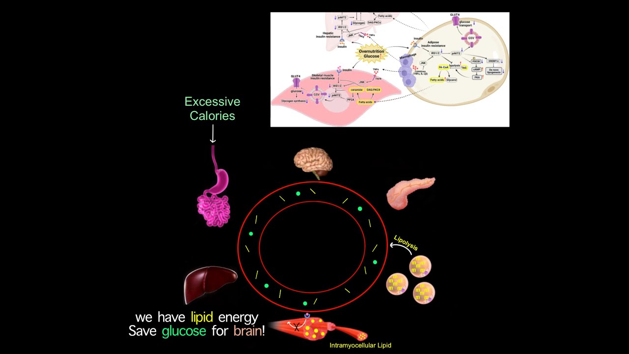 A Common Root Cause Of Chronic Diseases? Why Many Longevity Meds Treat Diabetes?(READ SUMMARY BELOW)