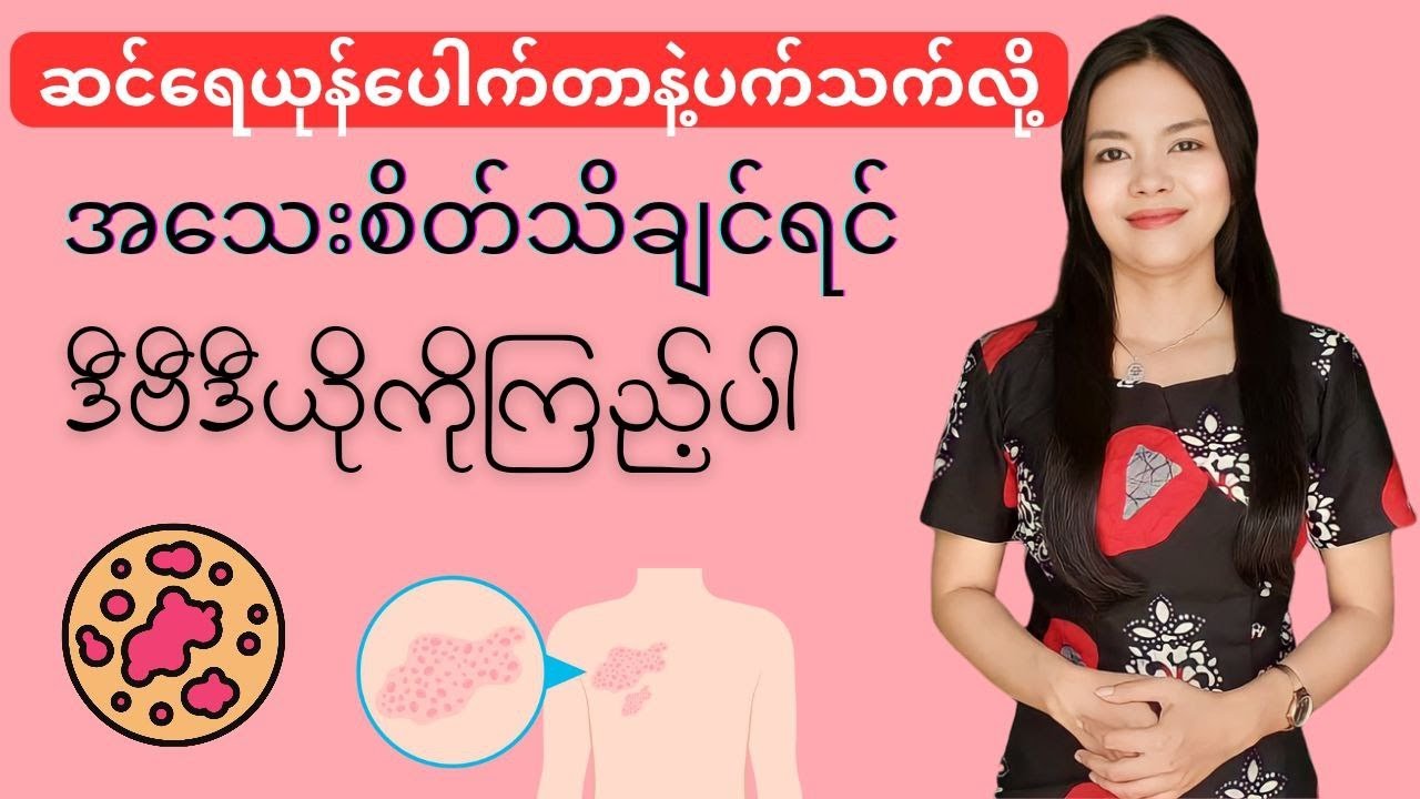 ဆင်ရေယုန်ရောဂါအကြောင်း-herpes
