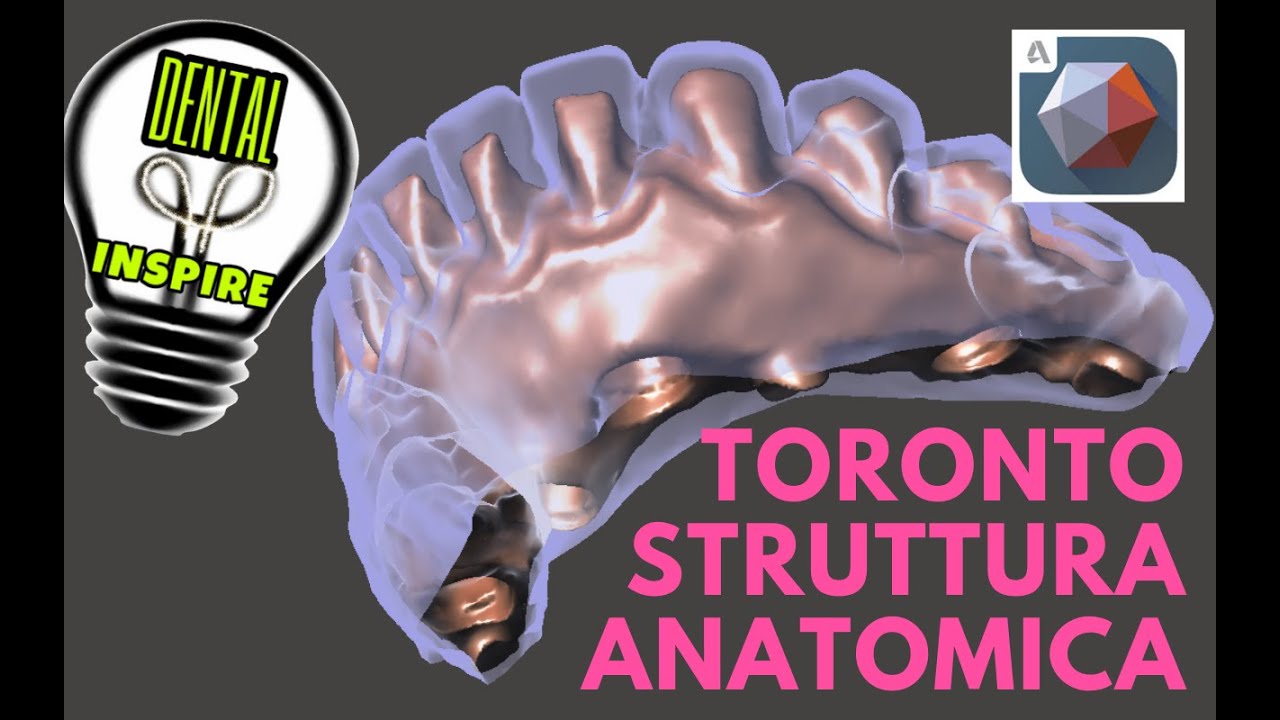 MESHMIXER DENTAL:TORONTO ANATOMICO, STRUTTURA PER INCOLLAGGIO