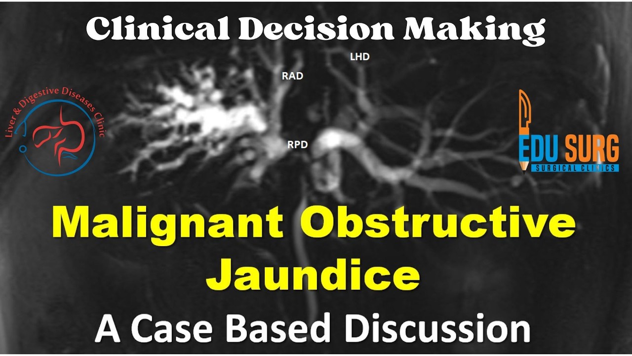 Case-based management of block at the liver hilum and hilar cholangiocarcinoma (Bile duct cancer)