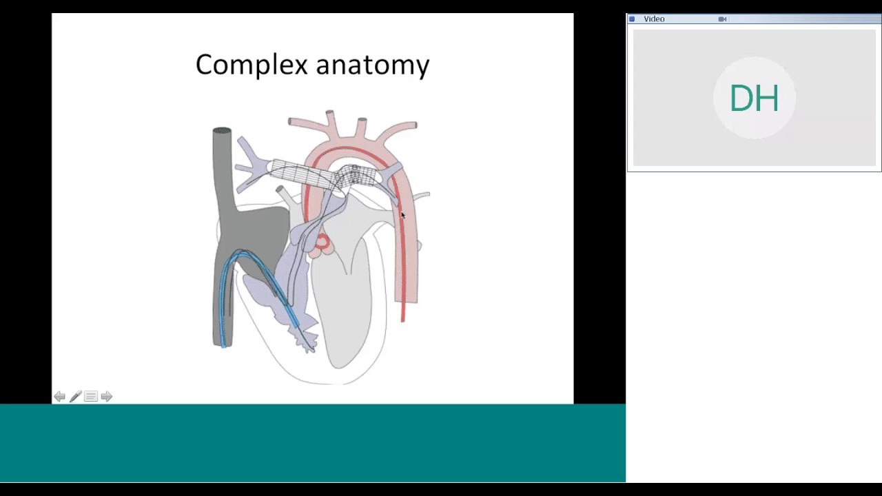 Cath Angio Views; which views for what lesion Quiz by Dr Nageswara Rao
