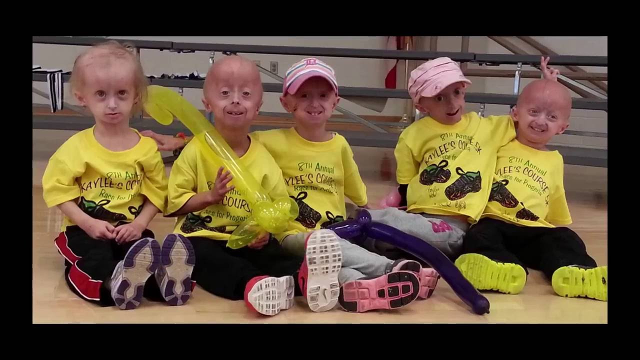 This is Who We Are ... Meet Children with Progeria