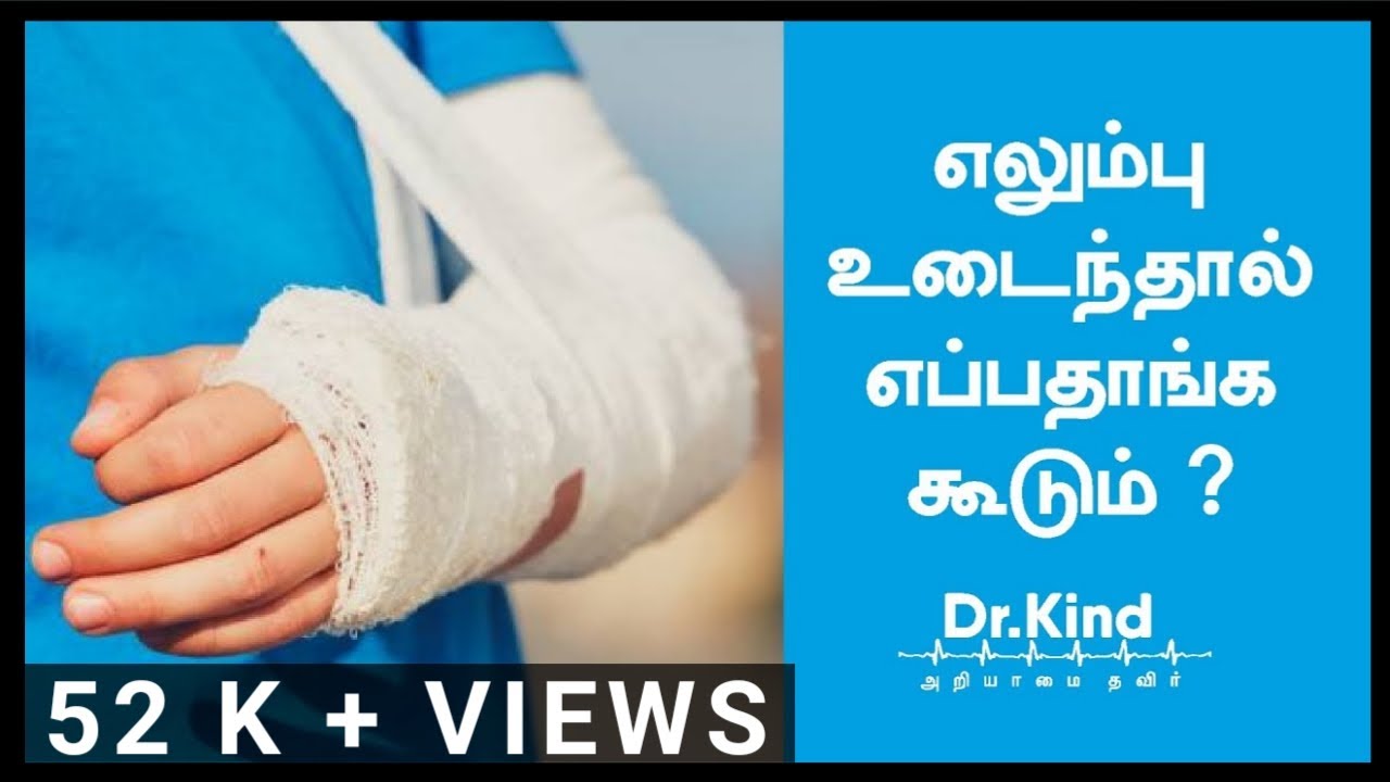 FRACTURE HEALING TIME # எலும்பு உடைந்தால் எப்பதாங்க கூடும்#