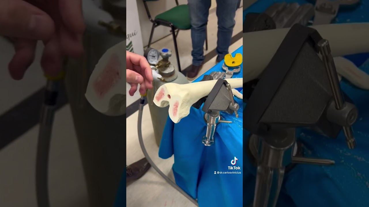 Como &eacute; feita a cirurgia pra colocar a pr&oacute;tese de joelho.