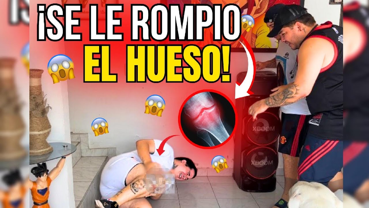 Me rompi la pierna (BROMITAAAA A MAO Y CARLOS ACEVEDO)
