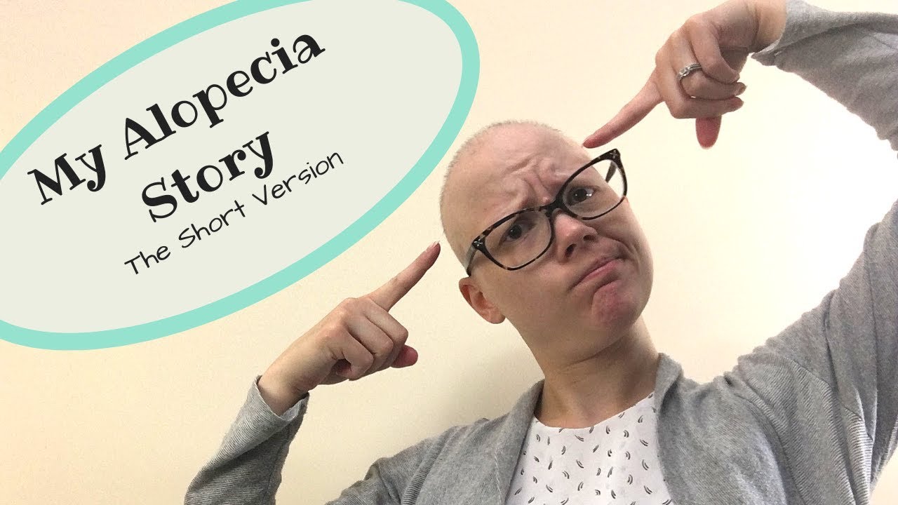 My Alopecia Story (Short version)