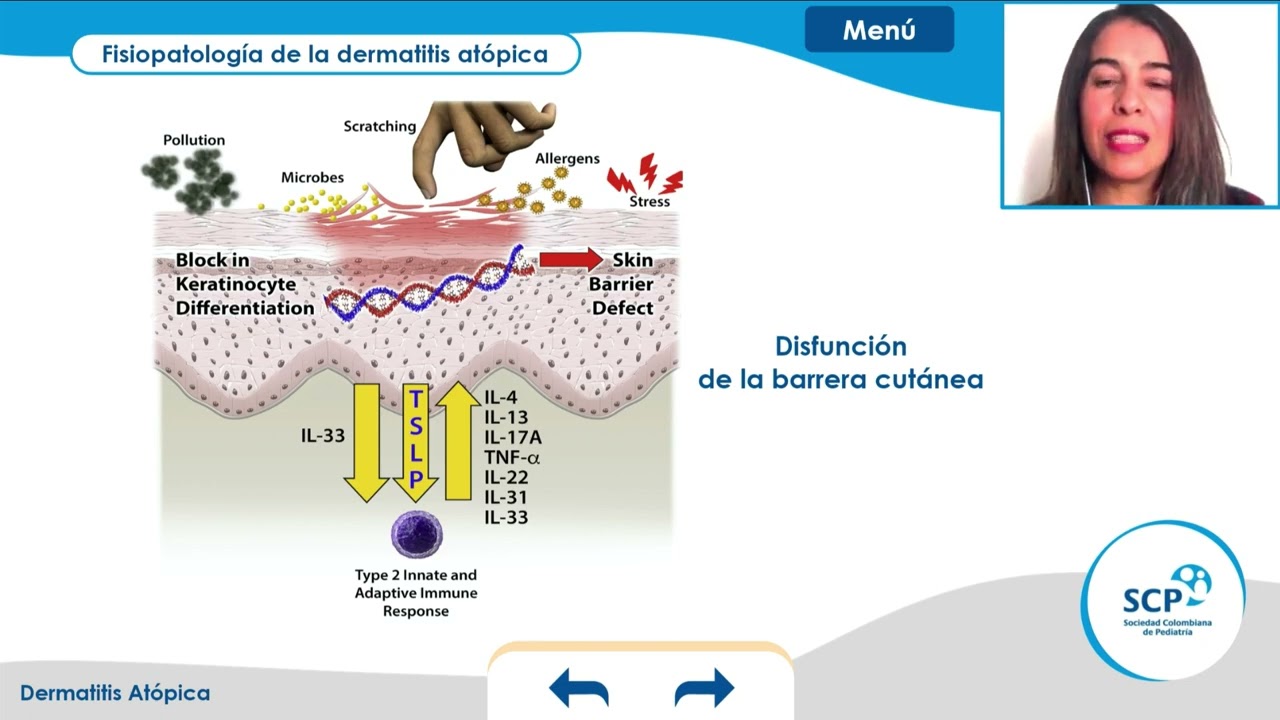 Dermatitis Atópica