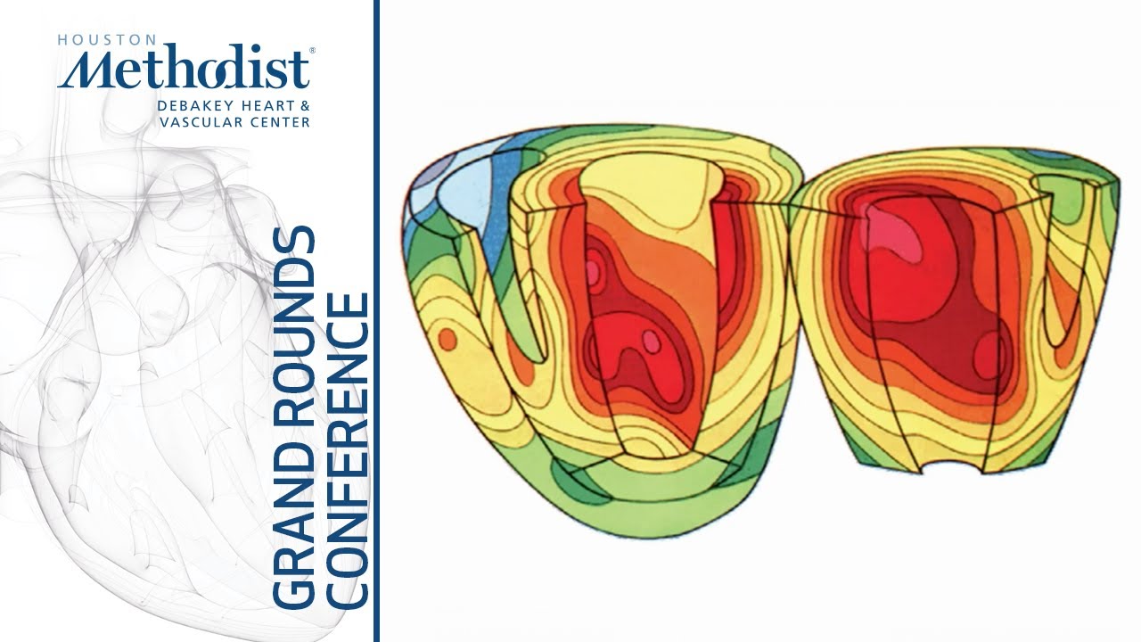 Conduction System Pacing: State of Current Practice (Kenneth A. Ellenbogen, MD) October 7, 2021