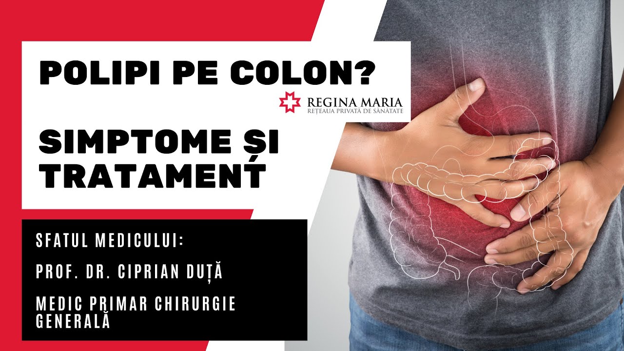 Polipi pe Colon: Ce Simptome si Ce Tratament Implica Polipoza