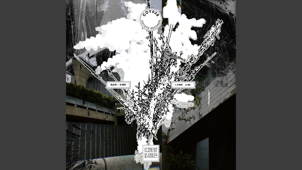 X-Ray