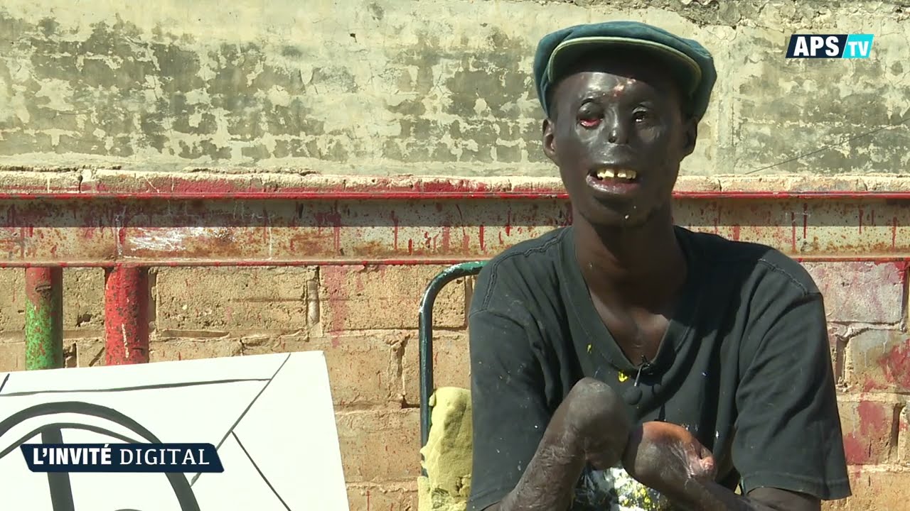 Invité Digital : Brûlé par la vie, illuminé par l'art : Guem Guem, un survivant qui peint l'espoir