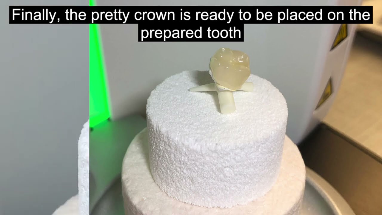How is a Same-Day CAD/CAM crown made?