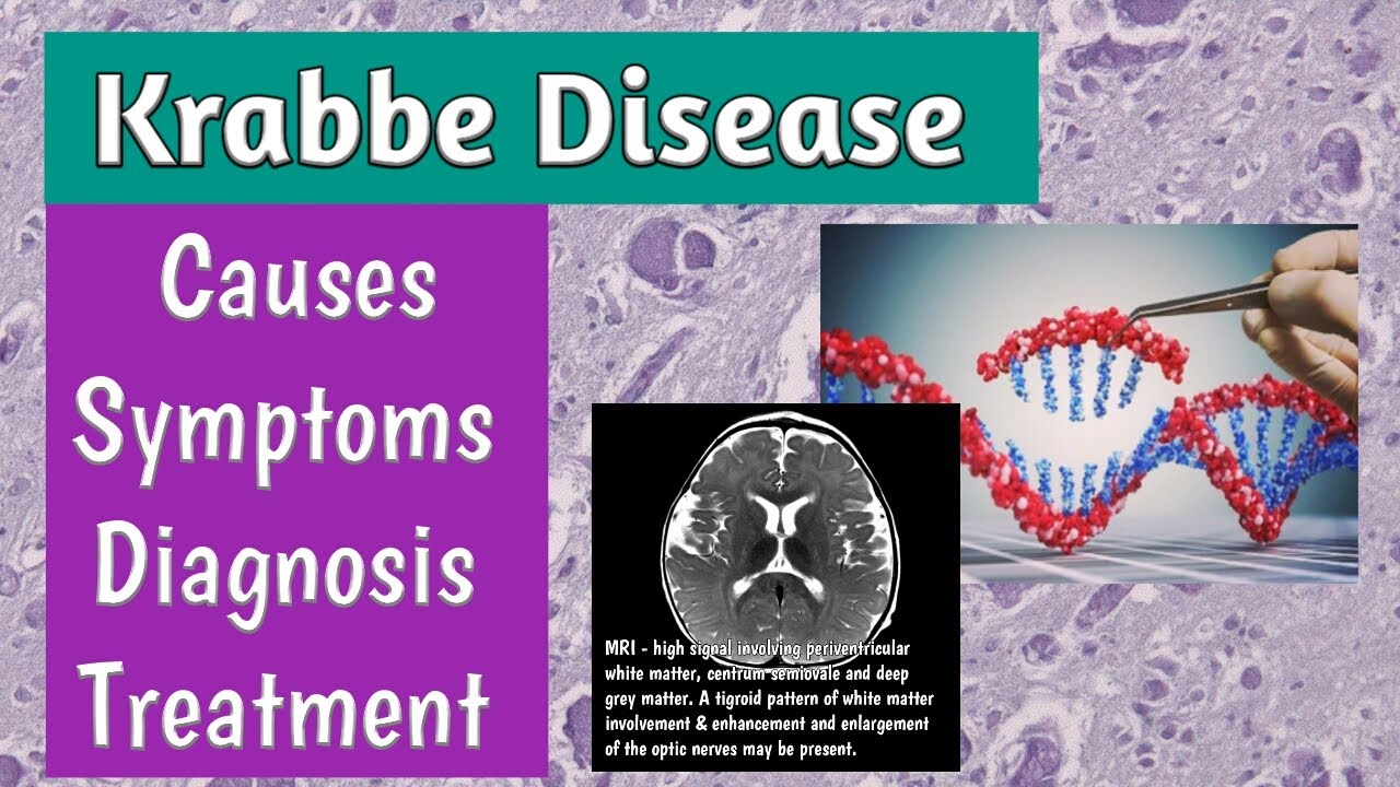Krabbe Disease Causes, Symptoms, Diagnosis & Treatment | Globoid Cell Leukodystrophy | MRCPCH & FCPS