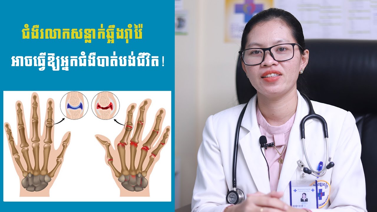ជំងឺរលាកសន្លាក់ឆ្អឹងរ៉ាំរ៉ៃ អាចធ្វើឱ្យអ្នកជំងឺបាត់បង់ជីវិត!