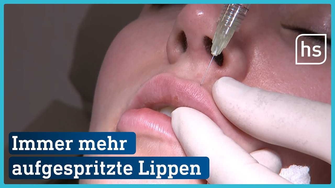 Aufgespritzte Lippen: Schönheitsideal oder gefährlicher Trend? | hessenschau