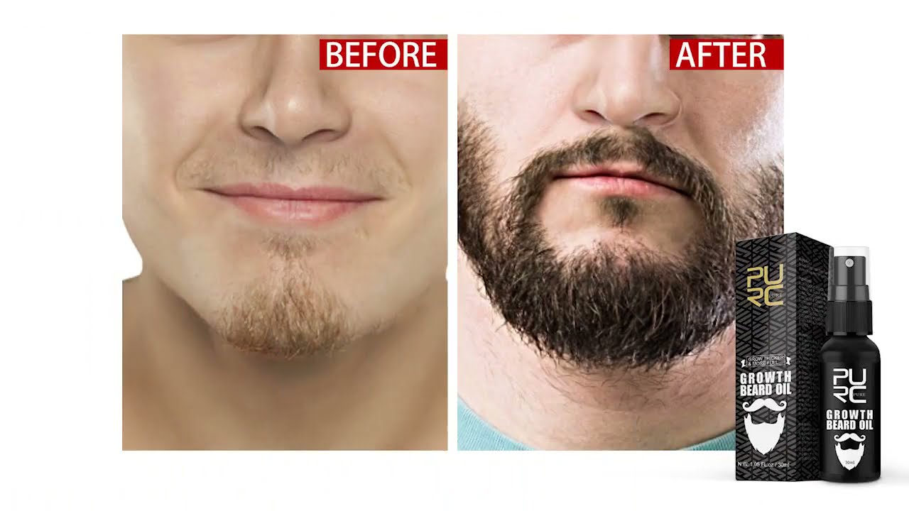 Óleo para Crescimento de Barba
