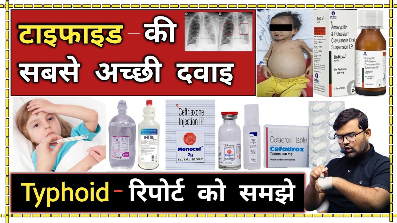 टाइफाइड बुखार | Typhoid Fever | Medicine | Treatment | Medicine Knowledge | Antibiotic | Pharmacy